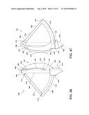 MIXING TOOL SET FOR A COOKING AND MIXING APPLIANCE KIT diagram and image