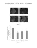 USE OF G-CSF DIMER IN PREPARATION OF MEDICAMENT FOR TREATMENT OF     NEURODEGENERATIVE DISEASES diagram and image