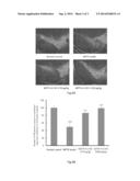 USE OF G-CSF DIMER IN PREPARATION OF MEDICAMENT FOR TREATMENT OF     NEURODEGENERATIVE DISEASES diagram and image