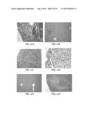 CONTROLLED RELEASE VACCINES AND METHODS FOR TREATING BRUCELLA DISEASES AND     DISORDERS diagram and image