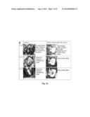 METHOD OF PREPARING A WOUND CARE DEVICE diagram and image