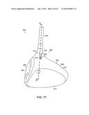 INTERCHANGEABLE SHAFT SYSTEM diagram and image