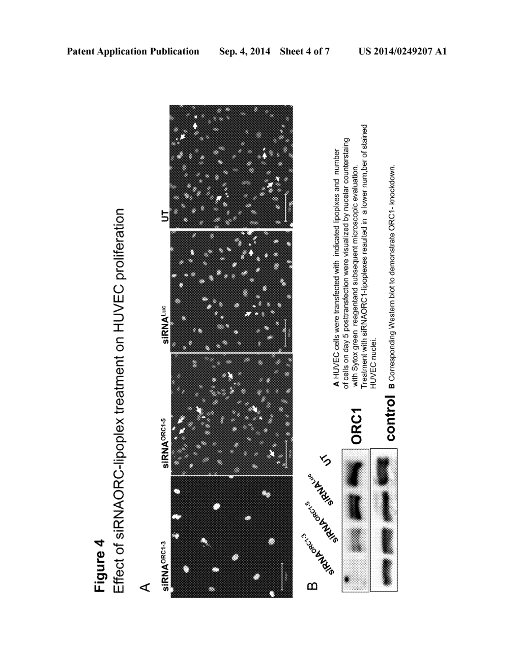 MEANS FOR INHIBITING THE EXPRESSION OF ORC-1 - diagram, schematic, and image 05