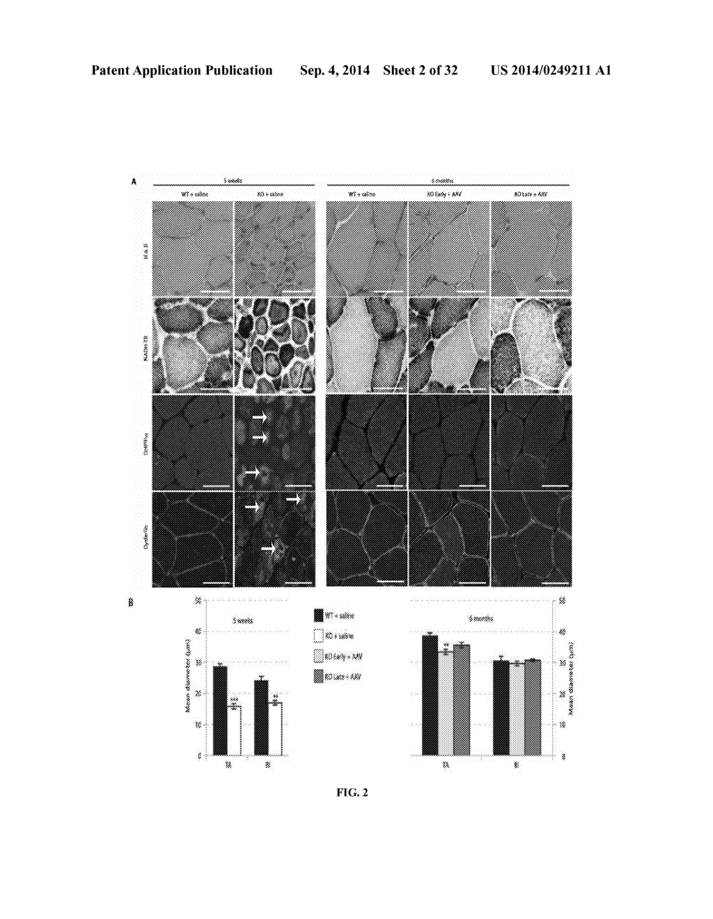 Systemic Gene Replacement Therapy for Treatment of X-Linked MyoTubular     Myopathy (XLMTM) - diagram, schematic, and image 03