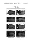 Compositions and Methods for Restoring the Stratum Corneum and Treating     Dermatological Diseases diagram and image