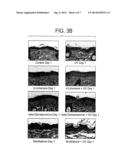 Compositions and Methods for Restoring the Stratum Corneum and Treating     Dermatological Diseases diagram and image