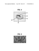 DEVICE AND METHOD FOR REPAIR OF UROLOGICAL STRUCTURES diagram and image