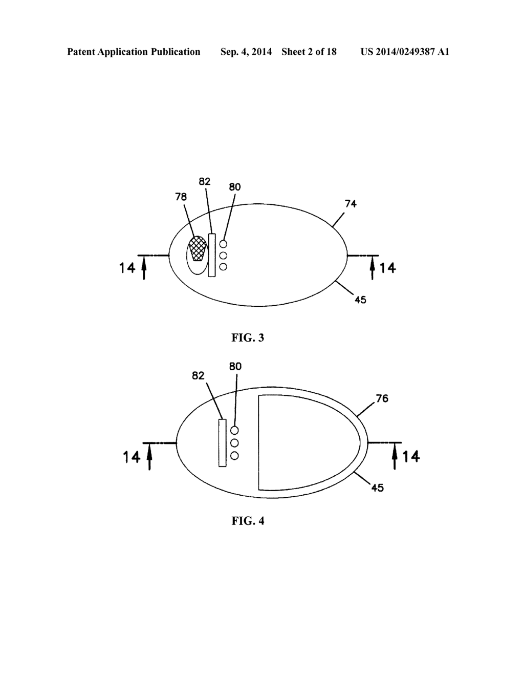 On-Body Medical Device Securement - diagram, schematic, and image 03