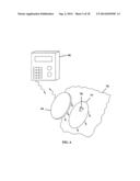 On-Body Medical Device Securement diagram and image