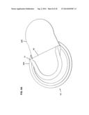 On-Body Medical Device Securement diagram and image