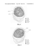 Method of Determining Affirmative and Negative Response Areas in a Human     Cerebral Cortex diagram and image