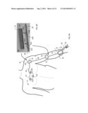 BODY-WORN SYSTEM FOR CONTINUOUS, NONINVASIVE MEASUREMENT OF CARDIAC     OUTPUT, STROKE VOLUME, CARDIAC POWER, AND BLOOD PRESSURE diagram and image