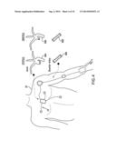 BODY-WORN SYSTEM FOR CONTINUOUS, NONINVASIVE MEASUREMENT OF CARDIAC     OUTPUT, STROKE VOLUME, CARDIAC POWER, AND BLOOD PRESSURE diagram and image