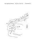 BODY-WORN SYSTEM FOR CONTINUOUS, NONINVASIVE MEASUREMENT OF CARDIAC     OUTPUT, STROKE VOLUME, CARDIAC POWER, AND BLOOD PRESSURE diagram and image