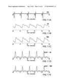 BODY-WORN SYSTEM FOR CONTINUOUS, NONINVASIVE MEASUREMENT OF CARDIAC     OUTPUT, STROKE VOLUME, CARDIAC POWER, AND BLOOD PRESSURE diagram and image