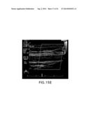 BODY-WORN SYSTEM FOR CONTINUOUS, NONINVASIVE MEASUREMENT OF CARDIAC     OUTPUT, STROKE VOLUME, CARDIAC POWER, AND BLOOD PRESSURE diagram and image