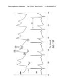 BODY-WORN SYSTEM FOR CONTINUOUS, NONINVASIVE MEASUREMENT OF CARDIAC     OUTPUT, STROKE VOLUME, CARDIAC POWER, AND BLOOD PRESSURE diagram and image