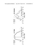 BODY-WORN SYSTEM FOR CONTINUOUS, NONINVASIVE MEASUREMENT OF CARDIAC     OUTPUT, STROKE VOLUME, CARDIAC POWER, AND BLOOD PRESSURE diagram and image