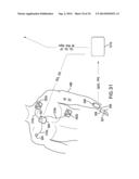 BODY-WORN SYSTEM FOR CONTINUOUS, NONINVASIVE MEASUREMENT OF CARDIAC     OUTPUT, STROKE VOLUME, CARDIAC POWER, AND BLOOD PRESSURE diagram and image