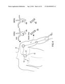 BODY-WORN SYSTEM FOR CONTINUOUS, NONINVASIVE MEASUREMENT OF CARDIAC     OUTPUT, STROKE VOLUME, CARDIAC POWER, AND BLOOD PRESSURE diagram and image