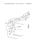 BODY-WORN SYSTEM FOR CONTINUOUS, NONINVASIVE MEASUREMENT OF CARDIAC     OUTPUT, STROKE VOLUME, CARDIAC POWER, AND BLOOD PRESSURE diagram and image