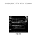 BODY-WORN SYSTEM FOR CONTINUOUS, NONINVASIVE MEASUREMENT OF CARDIAC     OUTPUT, STROKE VOLUME, CARDIAC POWER, AND BLOOD PRESSURE diagram and image