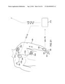 BODY-WORN SYSTEM FOR CONTINUOUS, NONINVASIVE MEASUREMENT OF CARDIAC     OUTPUT, STROKE VOLUME, CARDIAC POWER, AND BLOOD PRESSURE diagram and image