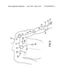 BODY-WORN SYSTEM FOR CONTINUOUS, NONINVASIVE MEASUREMENT OF CARDIAC     OUTPUT, STROKE VOLUME, CARDIAC POWER, AND BLOOD PRESSURE diagram and image