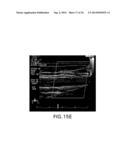 BODY-WORN SYSTEM FOR CONTINUOUS, NONINVASIVE MEASUREMENT OF CARDIAC     OUTPUT, STROKE VOLUME, CARDIAC POWER, AND BLOOD PRESSURE diagram and image