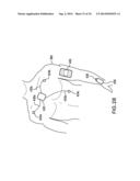 BODY-WORN SYSTEM FOR CONTINUOUS, NONINVASIVE MEASUREMENT OF CARDIAC     OUTPUT, STROKE VOLUME, CARDIAC POWER, AND BLOOD PRESSURE diagram and image