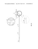 SYSTEMS AND METHODS FOR PERFORMING SURGICAL PROCEDURES AND ASSESSMENTS diagram and image