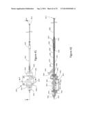 Insertable Endoscopic Instrument For Tissue Removal diagram and image