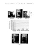 WOUND DRESSING AND METHOD OF TREATMENT diagram and image