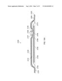 WOUND DRESSING AND METHOD OF TREATMENT diagram and image