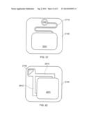 WOUND DRESSING AND METHOD OF TREATMENT diagram and image