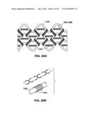 Moisture Transport System for Contact Electrocoagulation diagram and image