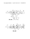 Moisture Transport System for Contact Electrocoagulation diagram and image