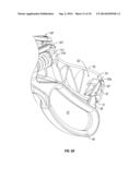 VESSEL SEALER AND DIVIDER FOR LARGE TISSUE STRUCTURES diagram and image