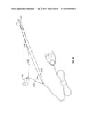 VESSEL SEALER AND DIVIDER FOR LARGE TISSUE STRUCTURES diagram and image