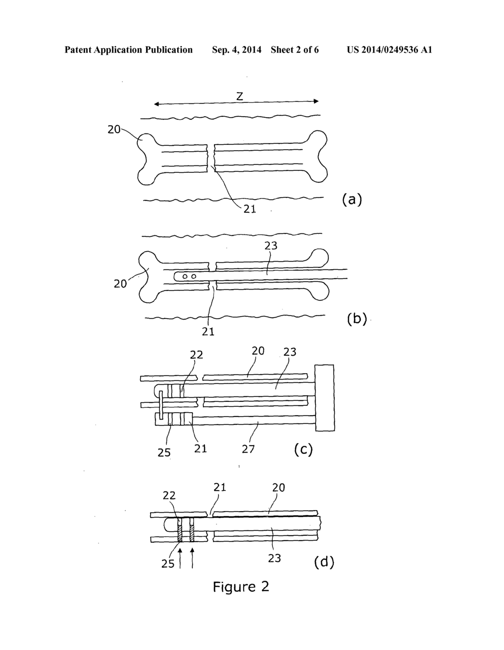 DISTAL LOCKING TARGETING DEVICE - diagram, schematic, and image 03