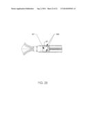 TISSUE RETRIEVAL SYSTEM diagram and image