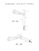 MINIMALLY INVASIVE SURGICAL TOWER ACCESS DEVICES AND RELATED METHODS diagram and image