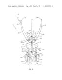 SPINAL CORRECTION SYSTEM AND METHOD diagram and image