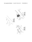 THIN FILM VASCULAR STENT AND BIOCOMPATIBLE SURFACE TREATMENT diagram and image