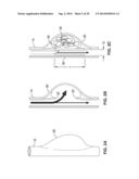 THIN FILM VASCULAR STENT AND BIOCOMPATIBLE SURFACE TREATMENT diagram and image