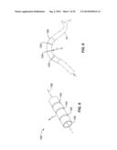 THIN FILM VASCULAR STENT AND BIOCOMPATIBLE SURFACE TREATMENT diagram and image