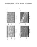 ULTRA-LOW FRACTIONAL AREA COVERAGE FLOW DIVERTER FOR TREATING ANEURYSMS     AND VASCULAR DISEASES diagram and image