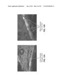 ULTRA-LOW FRACTIONAL AREA COVERAGE FLOW DIVERTER FOR TREATING ANEURYSMS     AND VASCULAR DISEASES diagram and image