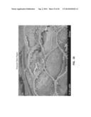 ULTRA-LOW FRACTIONAL AREA COVERAGE FLOW DIVERTER FOR TREATING ANEURYSMS     AND VASCULAR DISEASES diagram and image