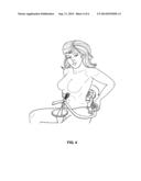 Bra Assistive Device diagram and image